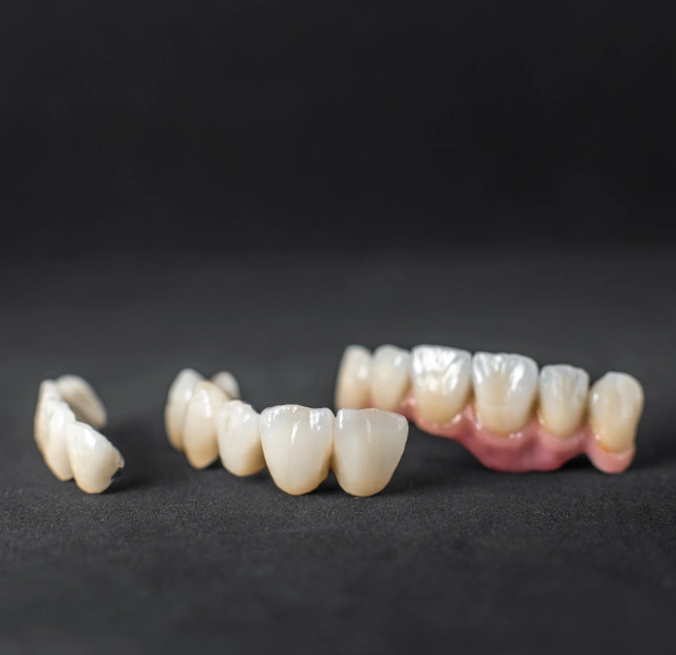 Porcelain Crowns